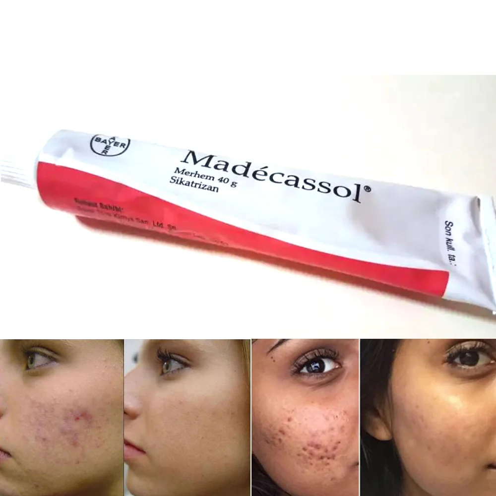 Madecassol krem